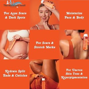 Advantages of using bio-oil for stretch marks