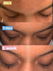 Eyelash Growth