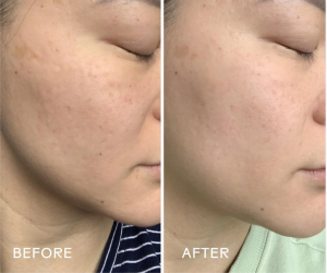 jojoba oil before after